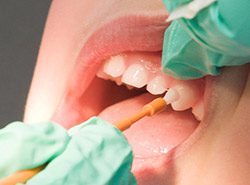 Fluoride - Critchfield Dental